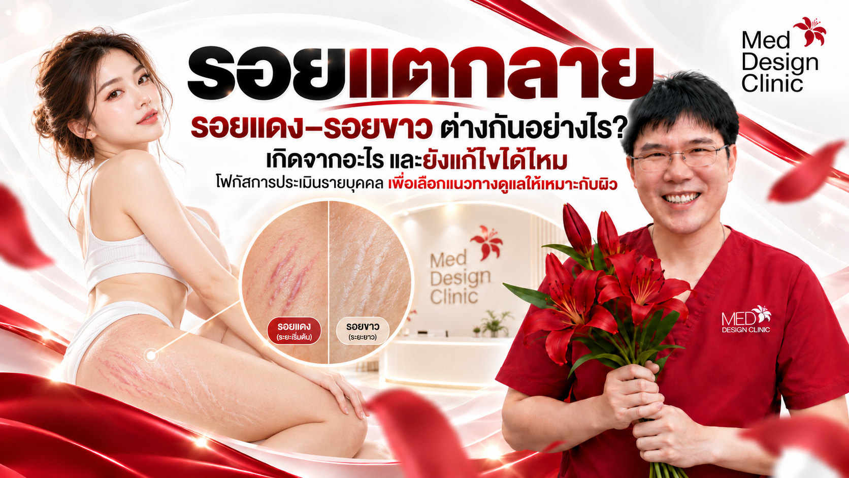 รอยแตกลายเกิดจากอะไร? รอยแดง–รอยขาวต่างกันอย่างไร และยังแก้ไขได้ไหม?